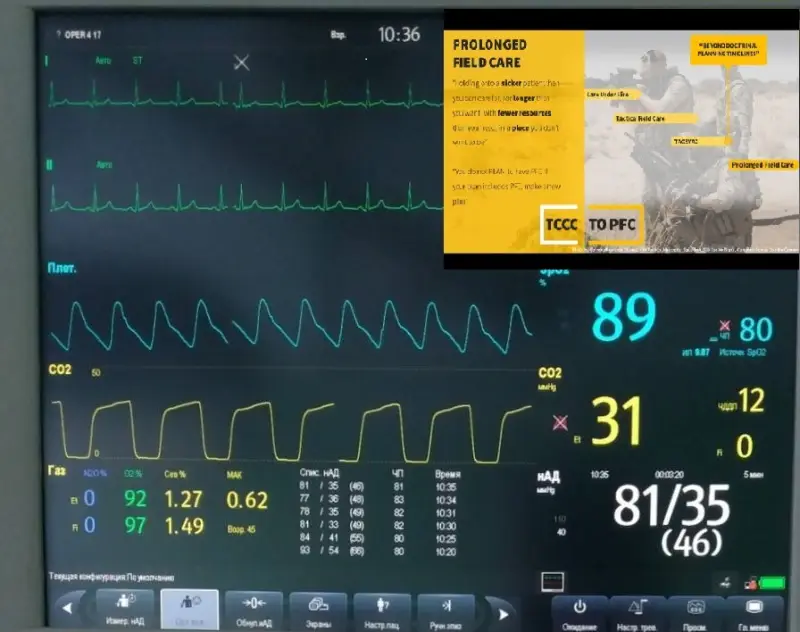 Тактическая медицина ВС РФ. Развитие и эволюция TCCC до СВО
