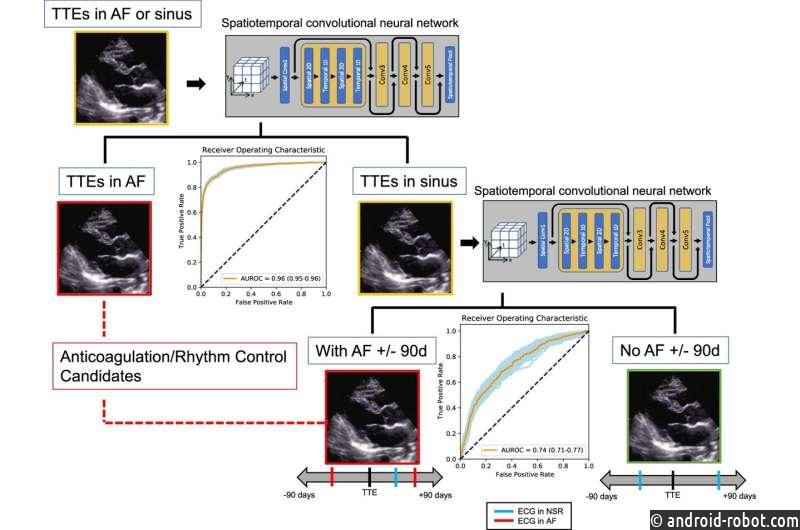 ИИ может помочь врачам раньше обнаружить аномальные сердечные ритмы