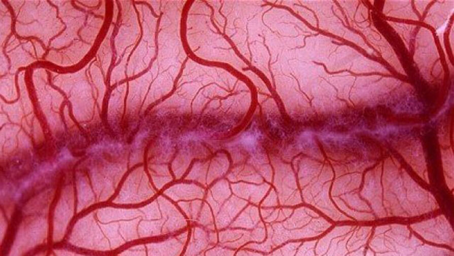 Ученые выяснили, какие части кровеносных сосудов подвержены опасному расширению