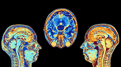 «Понять природу психических расстройств»: российские учёные создали подробную «карту жирности» мозга