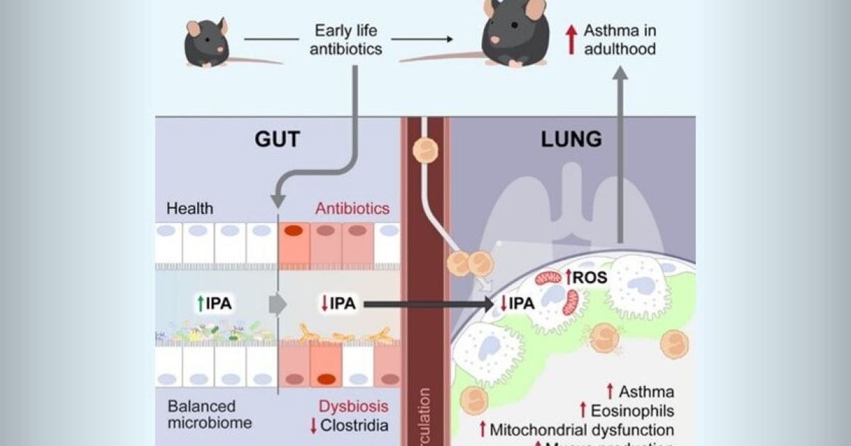 Прием антибиотиков в детстве повысил риск развития астмы у мышей во взрослом возрасте
