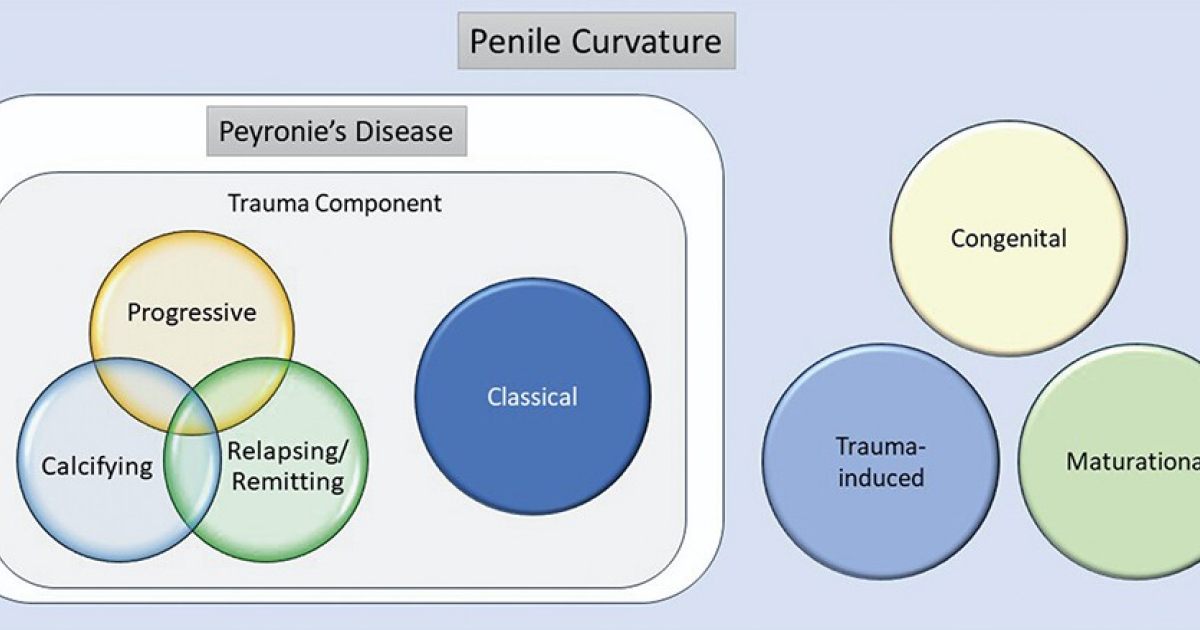 Урологи предложили новую классификацию деформаций пениса