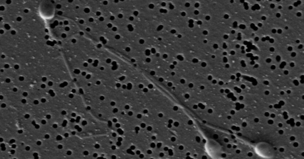 Папилломавирусы спровоцировали некроз сперматозоидов