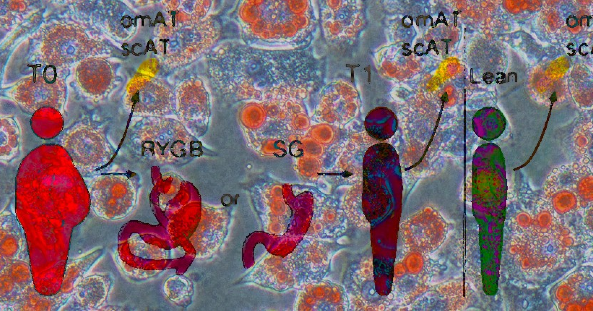 Жировые клетки сохранили память об ожирении после снижения массы тела