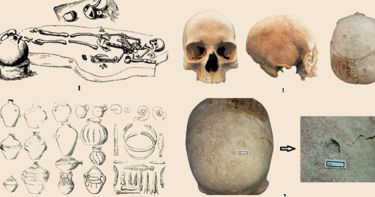 У скифской женщины из Закавказья выявили предсмертный перелом свода черепа