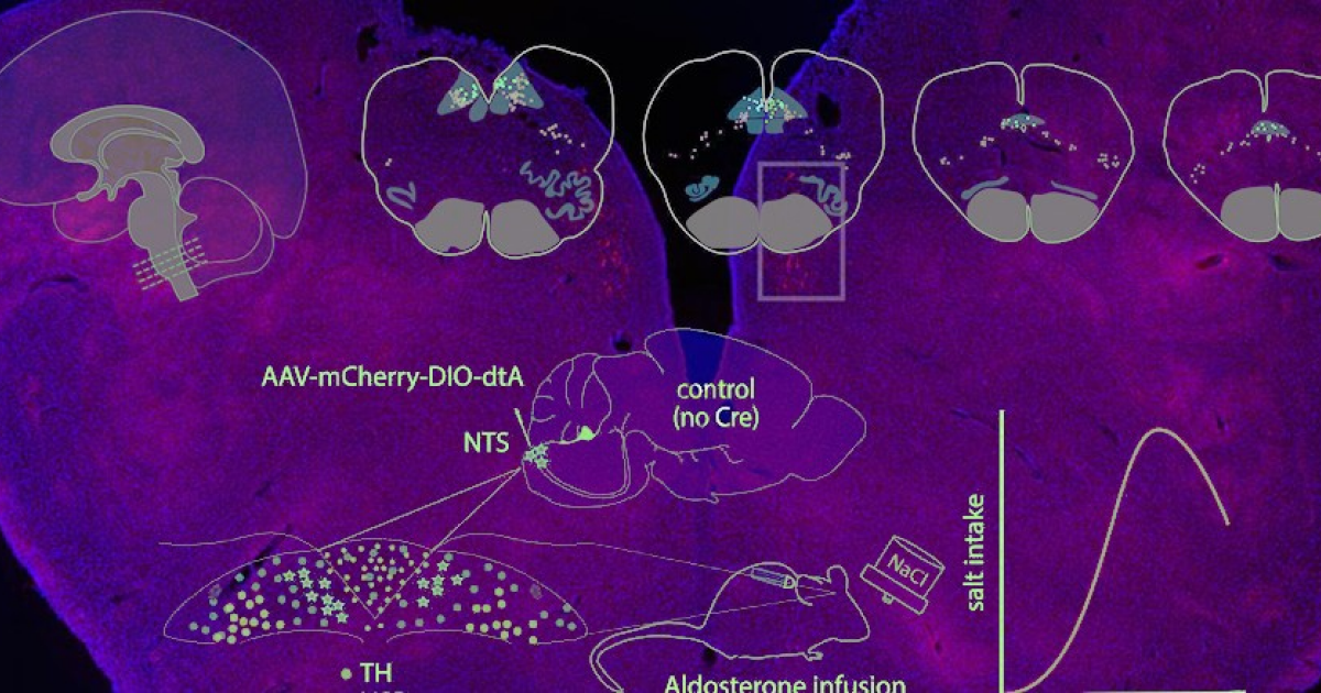 Тяга к соленому оказалась результатом стимуляции тысячи специализированных нейронов