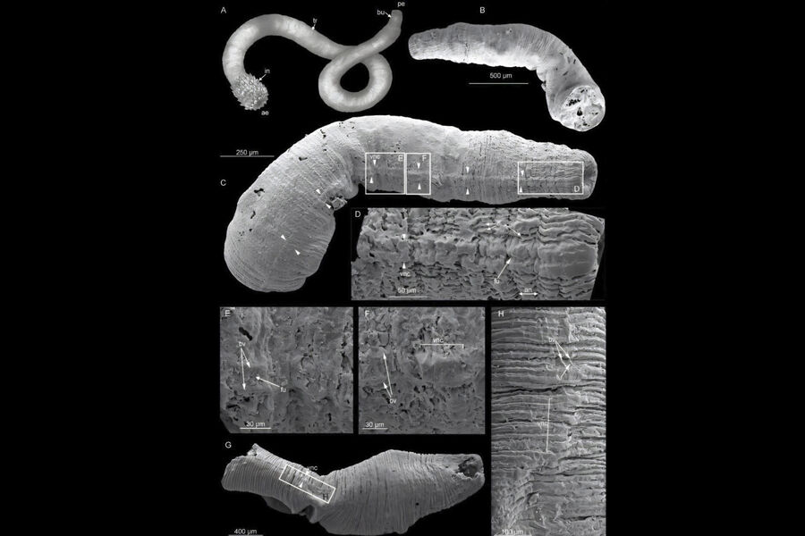 Раскрыт секрет эволюции нервной системы у древних нематод и пенисных червей