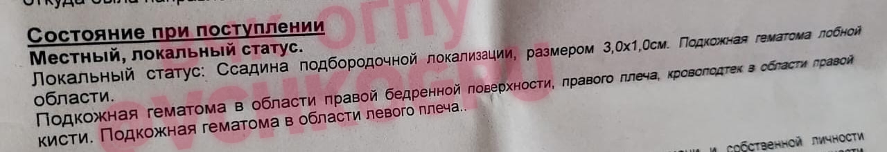 «Никита Мазепин неадекват, он не понимает, что такое боль»